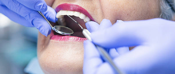 Best Emergency Broken Tooth Repair in Berkshire Lakes, FL